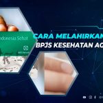 Cara Melahirkan Menggunakan BPJS Kesehatan