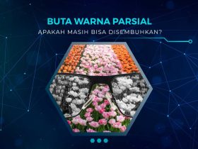 Apakah Buta Warna Parsial Bisa Disembuhkan