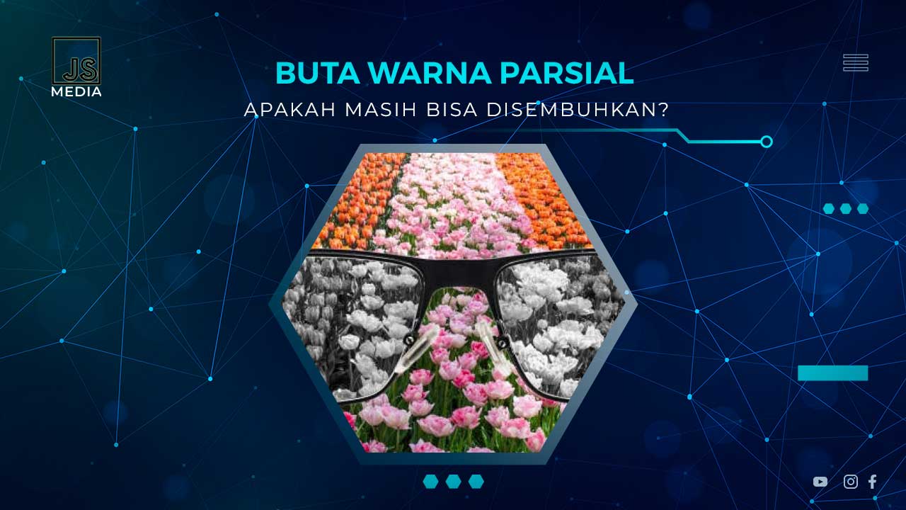 Apakah Buta Warna Parsial Bisa Disembuhkan