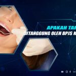 Apakah Tambal Gigi Ditanggung BPJS Kesehatan