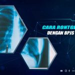 Cara Rontgen Gratis Dengan BPJS Kesehatan