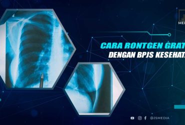 Cara Rontgen Gratis Dengan BPJS Kesehatan