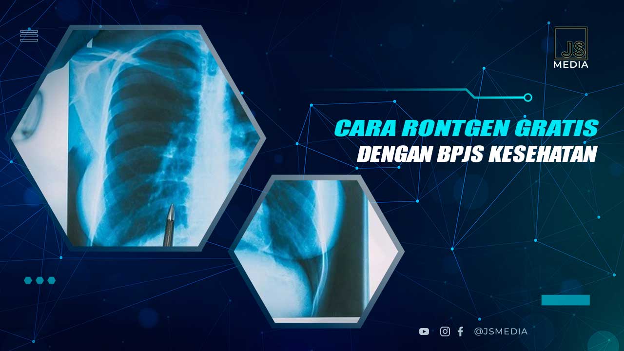 Cara Rontgen Gratis Dengan BPJS Kesehatan