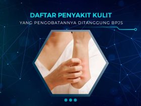 Daftar Penyakit Kulit yang Ditangung BPJS Kesehatan