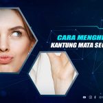 Cara Menghilangkan Kantung Mata