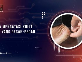 Solusi Kulit Kaki Pecah-Pecah