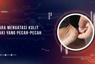 Solusi Kulit Kaki Pecah-Pecah