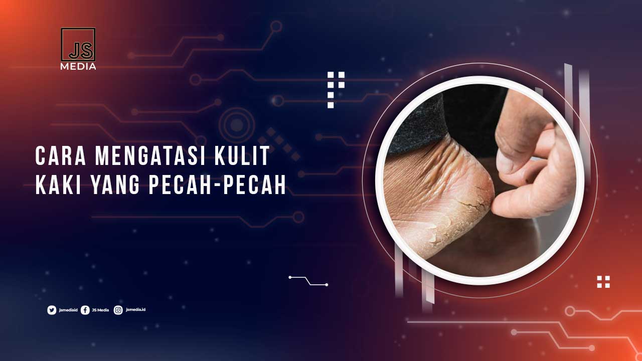 Solusi Kulit Kaki Pecah-Pecah